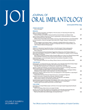Safety of Antiresorptive Drugs for Dental Implant Procedures