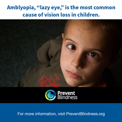 Prevent Blindness Declares August as Children's Eye Health and Safety Month to Help Educate Families on the Importance of Healthy Vision and Early Access to Eyecare